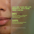 Murad Biome-Balancing Calm and Recover Cream
