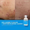 Murad Deep Relief Blemish Treatment