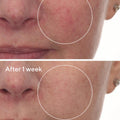 Murad Cellular Hydration Repair Serum