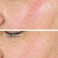Murad Intense Recovery Cream