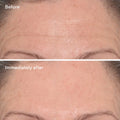 Murad Targeted Wrinkle Corrector
