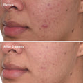 Murad Rapid Dark Spot Correcting Serum