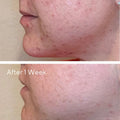 Murad Daily Clarifying Peel