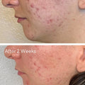 Murad Daily Clarifying Peel