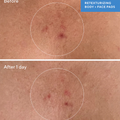 Murad Retexturizing Body Pads